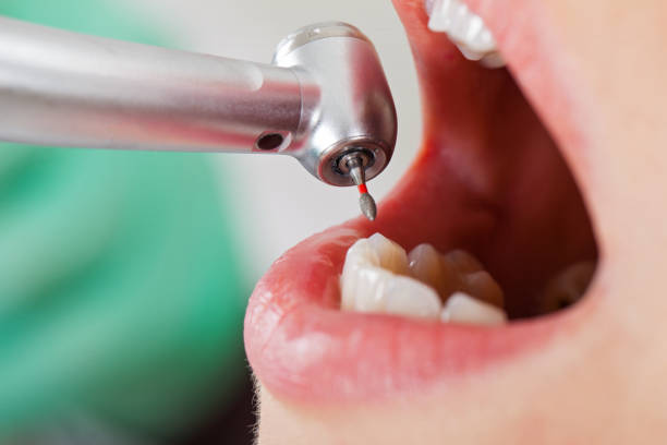 Best Emergency Denture Repair in Lambertville, NJ